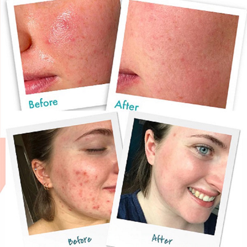 کرم ترميم کننده اون Avene مدل سیکالفیت 40 ميلي ليتر